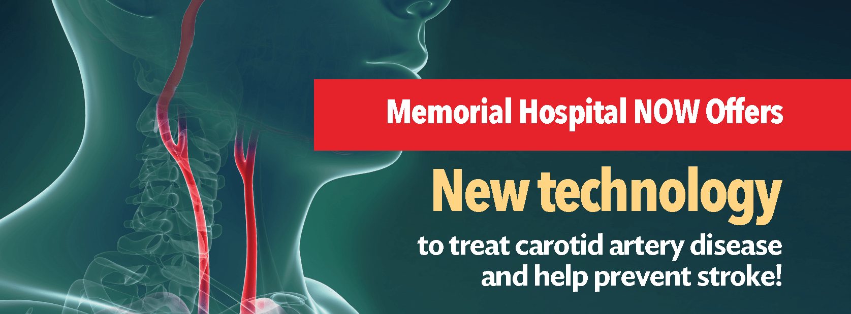 Memorial Hospital now offers new technology to treat carotid artery disease and help prevent stroke!