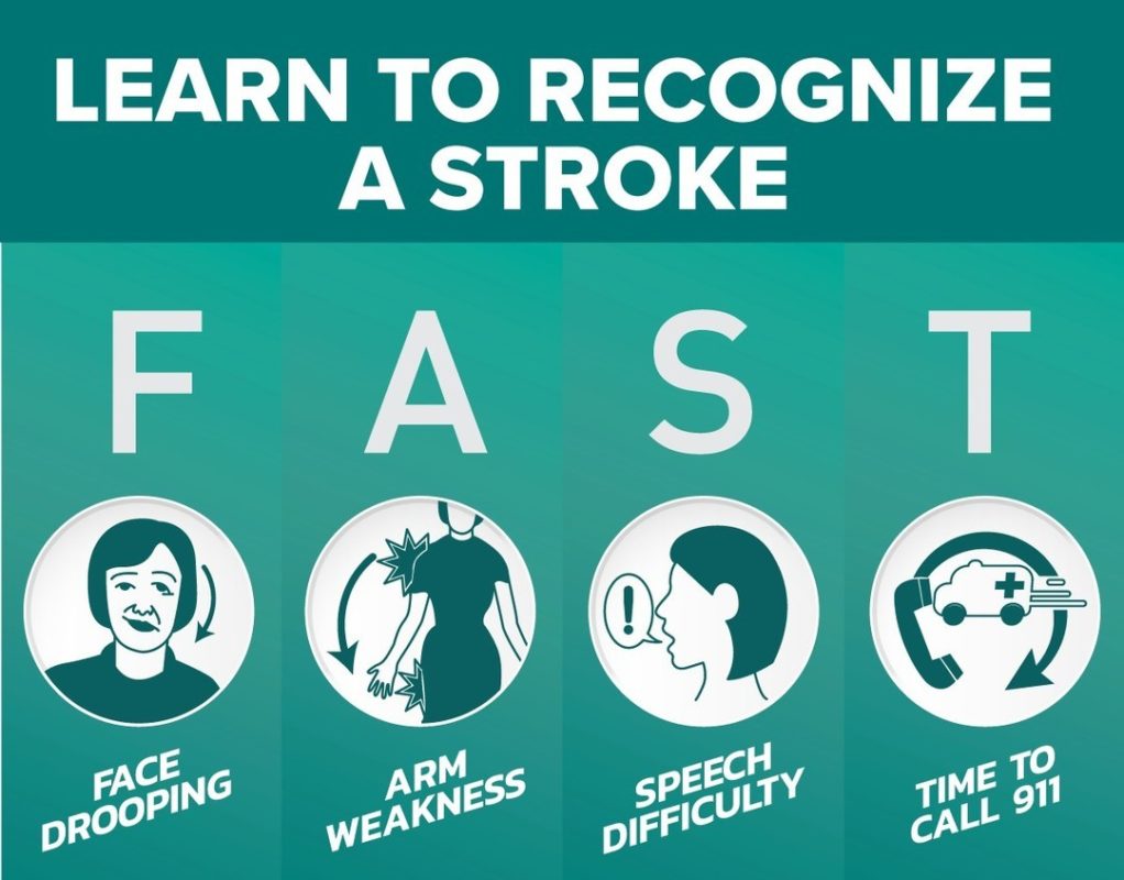 identifying-stroke-in-men-and-women-memorial-health-system