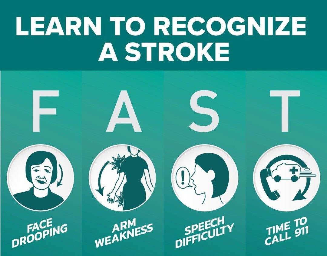 FAST - symptoms of a stroke